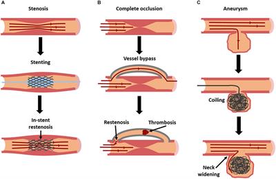 Targeted Delivery of Bioactive Molecules for Vascular Intervention and Tissue Engineering